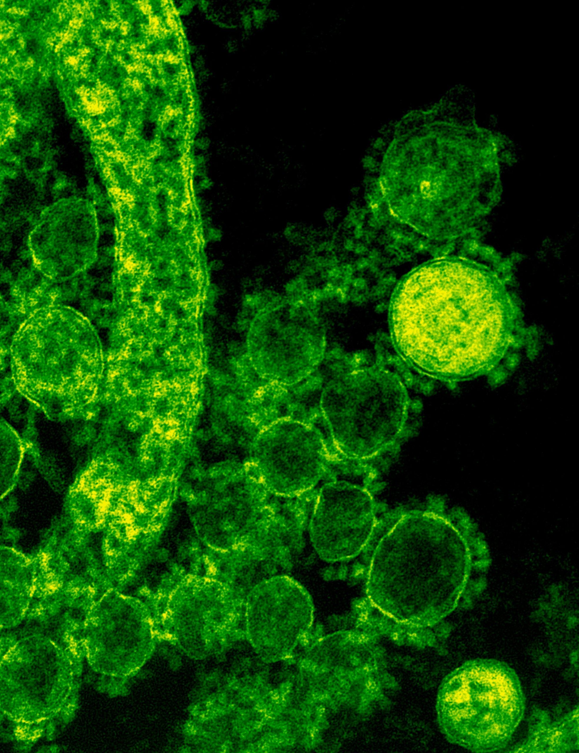 Gut bacteria